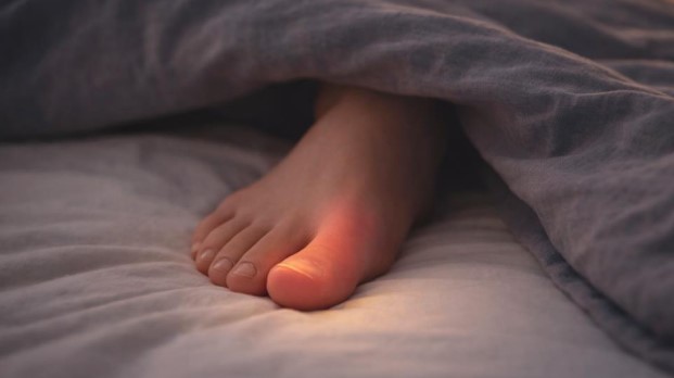 Burning sensation in big toe at night with foot under blanket