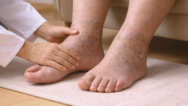 diabetic foot care