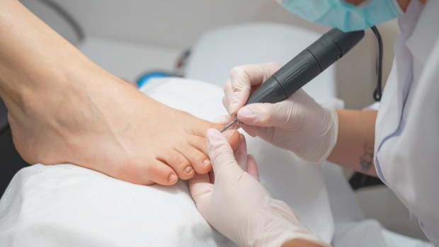 Close-up showing how do podiatrists treat ingrown toenails in a sterile clinical setting for pain relief.