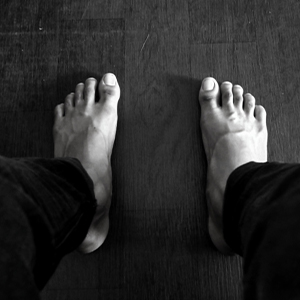 Foot showing skin changes that require routine diabetic foot care.